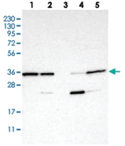 C7orf20, Rabbit, Polyclonal Antibody, Abnova 100&mu;L; Unlabeled:Antibodies,