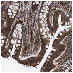 C7orf20, Rabbit, Polyclonal Antibody, Abnova 100&mu;L; Unlabeled:Antibodies,