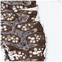 TRIOBP Rabbit anti-Human, Polyclonal Antibody, Abnova 100&mu;L; Unlabeled:Antibodies,