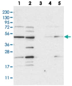 NAPEPLD Rabbit anti-Human, Polyclonal Antibody, Abnova 100&mu;L; Unlabeled:Antibodies,