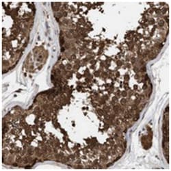 FIT1, Rabbit, Polyclonal Antibody, Abnova 100&mu;L; Unlabeled:Antibodies,