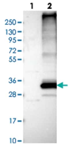 FIT1, Rabbit, Polyclonal Antibody, Abnova 100&mu;L; Unlabeled:Antibodies,