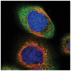 CBLB Rabbit anti-Human, Polyclonal Antibody, Abnova 100&mu;L; Unlabeled:Antibodies,