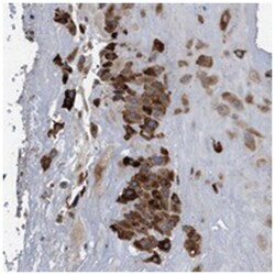 PPM1L Rabbit anti-Human, Polyclonal Antibody, Abnova 100&mu;L; Unlabeled:Antibodies,