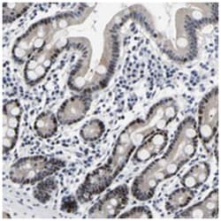 PTRHD1, Rabbit, Polyclonal Antibody, Abnova 100 &mu;L | Buy Online | Abnova Corporation | Fisher Scientific