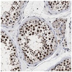 RRP1B Rabbit anti-Human, Polyclonal Antibody, Abnova 100&mu;L; Unlabeled:Antibodies,
