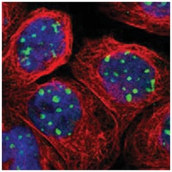 RRP1B Rabbit anti-Human, Polyclonal Antibody, Abnova 100&mu;L; Unlabeled:Antibodies,