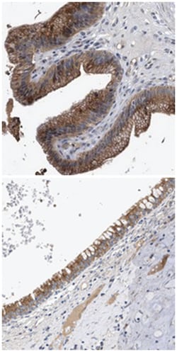 CCDC146 Rabbit anti-Human, Polyclonal Antibody, Abnova 100&mu;L; Unlabeled:Antibodies,