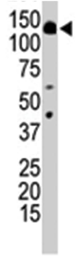 PIK3R4, Rabbit, Polyclonal Antibody, Abnova 400 &mu;L | Buy Online | Abnova Corporation | Fisher Scientific