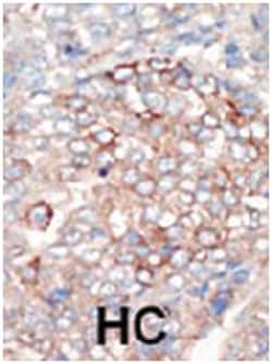 PIK3R4, Rabbit, Polyclonal Antibody, Abnova 400 &mu;L | Buy Online | Abnova Corporation | Fisher Scientific