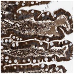 PNPLA8 Rabbit anti-Human, Polyclonal Antibody, Abnova 100 &mu;L | Buy Online | Abnova Corporation | Fisher Scientific