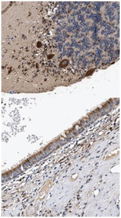 CCDC146 Rabbit anti-Human, Polyclonal Antibody, Abnova 100&mu;L; Unlabeled:Antibodies,