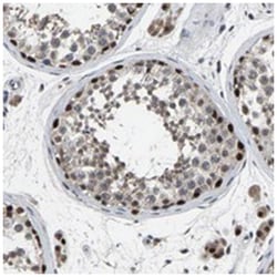 LSM8, Rabbit, Polyclonal Antibody, Abnova 100&mu;L; Unlabeled:Antibodies,