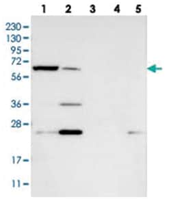 KLHDC10, Rabbit, Polyclonal Antibody, Abnova 100&mu;L; Unlabeled:Antibodies,