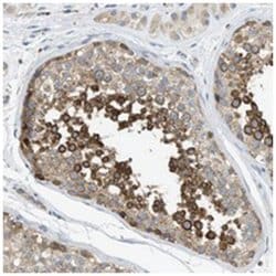 KLHDC10, Rabbit, Polyclonal Antibody, Abnova 100&mu;L; Unlabeled:Antibodies,