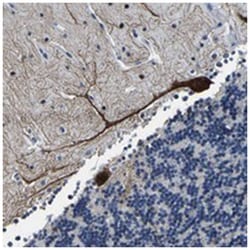 UBN2 Rabbit anti-Human, Polyclonal Antibody, Abnova 100&mu;L; Unlabeled:Antibodies,