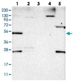 DDX25, Rabbit, Polyclonal Antibody, Abnova 100&mu;L; Unlabeled:Antibodies,
