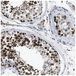 DDX25, Rabbit, Polyclonal Antibody, Abnova 100&mu;L; Unlabeled:Antibodies,