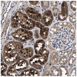 CACNA1D, Rabbit, Polyclonal Antibody, Abnova 100 &mu;L | Buy Online | Abnova Corporation | Fisher Scientific
