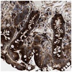 AMZ1, Rabbit, Polyclonal Antibody, Abnova 100 &mu;L | Buy Online | Abnova Corporation | Fisher Scientific