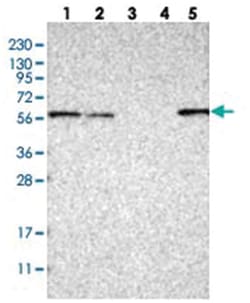 DBNL Rabbit anti-Human, Polyclonal Antibody, Abnova 100&mu;L; Unlabeled:Antibodies,
