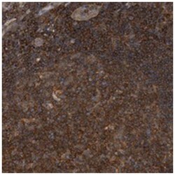 DBNL Rabbit anti-Human, Polyclonal Antibody, Abnova 100&mu;L; Unlabeled:Antibodies,
