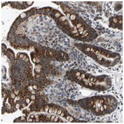 SLIRP Rabbit anti-Human, Polyclonal Antibody, Abnova 100 &mu;L | Buy Online | Abnova Corporation | Fisher Scientific