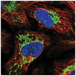 SLIRP Rabbit anti-Human, Polyclonal Antibody, Abnova 100 &mu;L | Buy Online | Abnova Corporation | Fisher Scientific