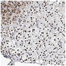 C9orf80, Rabbit, Polyclonal Antibody, Abnova 100 &mu;L | Buy Online | Abnova Corporation | Fisher Scientific