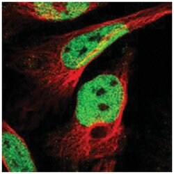 C9orf80, Rabbit, Polyclonal Antibody, Abnova 100 &mu;L | Buy Online | Abnova Corporation | Fisher Scientific