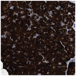 ZC3HAV1L, Rabbit, Polyclonal Antibody, Abnova 100&mu;L; Unlabeled:Antibodies,