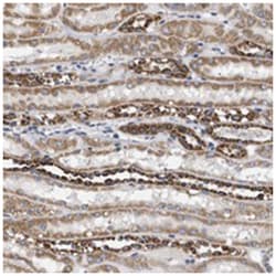 TMEM168, Rabbit, Polyclonal Antibody, Abnova 100 &mu;L | Buy Online | Abnova Corporation | Fisher Scientific