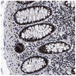 C9orf82 Rabbit anti-Human, Polyclonal Antibody, Abnova 100 &mu;L | Buy Online | Abnova Corporation | Fisher Scientific