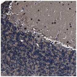 RSBN1L Rabbit anti-Human, Polyclonal Antibody, Abnova 100 &mu;L | Buy Online | Abnova Corporation | Fisher Scientific