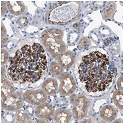 PKD1L1 Rabbit anti-Human, Polyclonal Antibody, Abnova 100 &mu;L | Buy Online | Abnova Corporation | Fisher Scientific