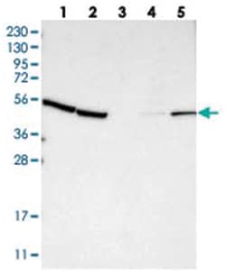 KLHDC1, Rabbit, Polyclonal Antibody, Abnova 100 &mu;L | Buy Online | Abnova Corporation | Fisher Scientific