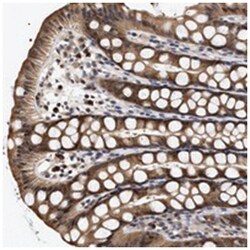 KLHDC1, Rabbit, Polyclonal Antibody, Abnova 100 &mu;L | Buy Online | Abnova Corporation | Fisher Scientific