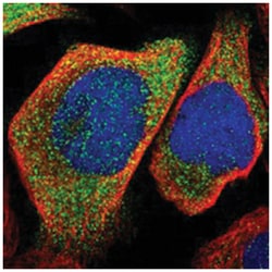 KLHDC1, Rabbit, Polyclonal Antibody, Abnova 100 &mu;L | Buy Online | Abnova Corporation | Fisher Scientific