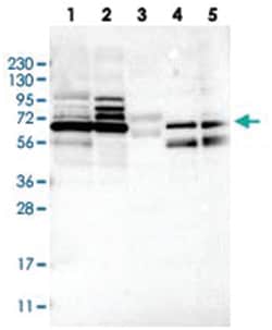 MUM1L1 Rabbit anti-Human, Polyclonal Antibody, Abnova 100 &mu;L | Buy Online | Abnova Corporation | Fisher Scientific