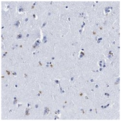LRRC8E, Rabbit, Polyclonal Antibody, Abnova 100 &mu;L | Buy Online | Abnova Corporation | Fisher Scientific
