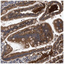 FAM185A Rabbit anti-Human, Polyclonal Antibody, Abnova 100 &mu;L | Buy Online | Abnova Corporation | Fisher Scientific