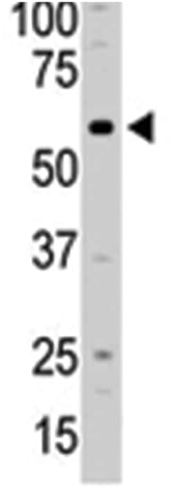 PI4K2A, Rabbit, Polyclonal Antibody, Abnova 400&mu;L; Unlabeled:Antibodies,