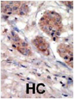PI4K2A, Rabbit, Polyclonal Antibody, Abnova 400&mu;L; Unlabeled:Antibodies,