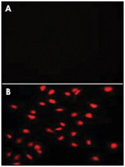 PI4K2A, Rabbit, Polyclonal Antibody, Abnova 400&mu;L; Unlabeled:Antibodies,
