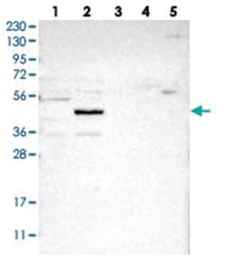 NSUN5, Rabbit, Polyclonal Antibody, Abnova 100&mu;L; Unlabeled:Antibodies,