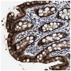 NSUN5, Rabbit, Polyclonal Antibody, Abnova 100&mu;L; Unlabeled:Antibodies,