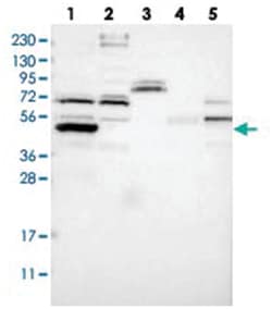 LRRC72, Rabbit, Polyclonal Antibody, Abnova 100 &mu;L | Buy Online | Abnova Corporation | Fisher Scientific