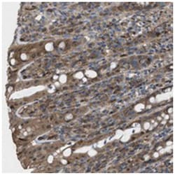 LRRC72, Rabbit, Polyclonal Antibody, Abnova 100 &mu;L | Buy Online | Abnova Corporation | Fisher Scientific
