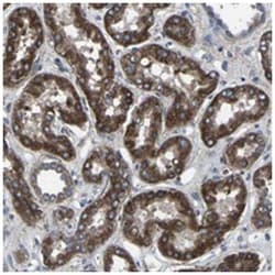 KIAA1958, Rabbit, Polyclonal Antibody, Abnova 100 &mu;L | Buy Online | Abnova Corporation | Fisher Scientific