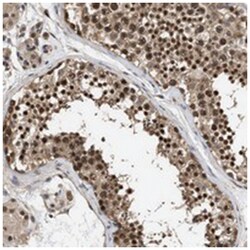 C9orf126, Rabbit, Polyclonal Antibody, Abnova 100 &mu;L | Buy Online | Abnova Corporation | Fisher Scientific